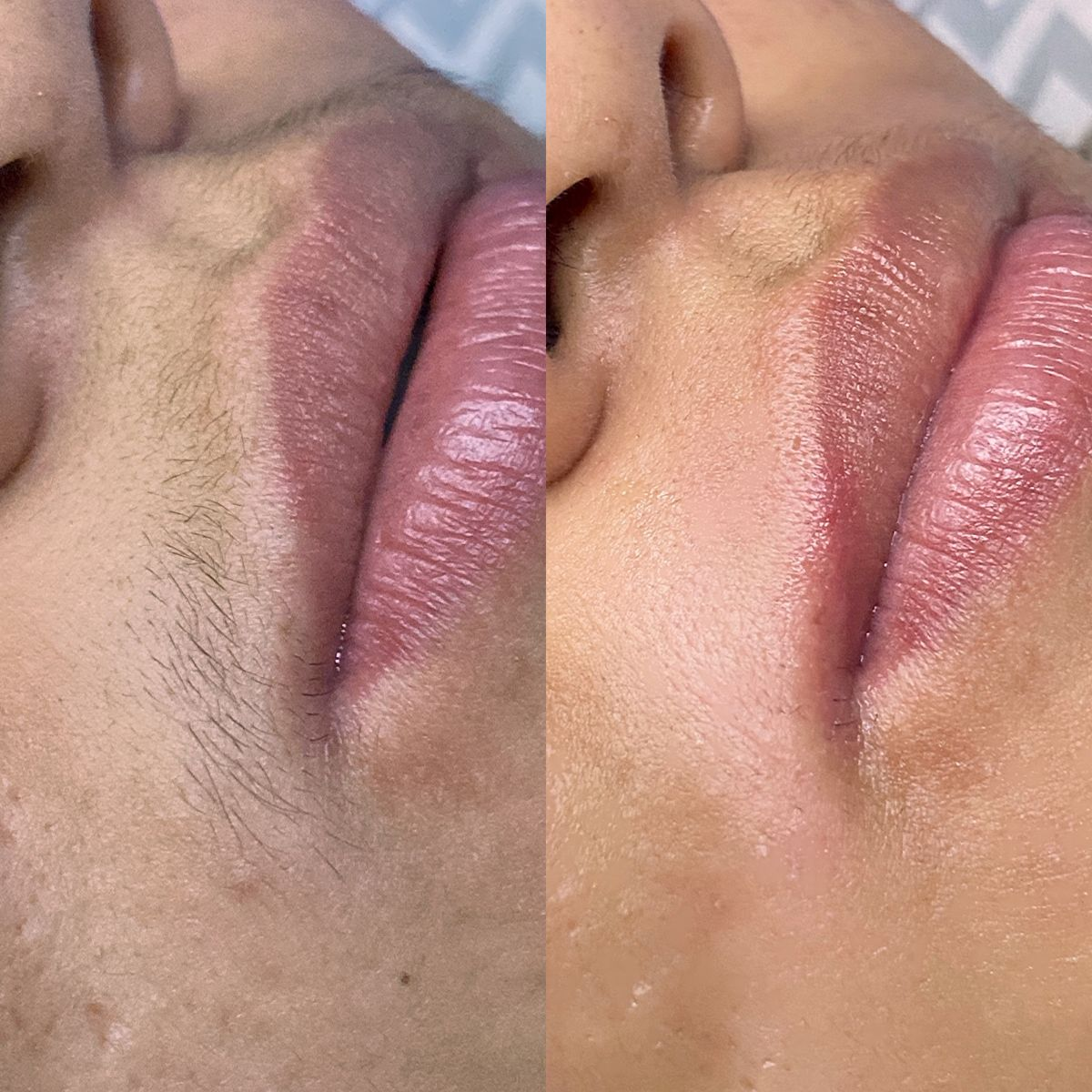 Upper Lip Wax at Ultimate Renew Spa in Georgetown, Guyana